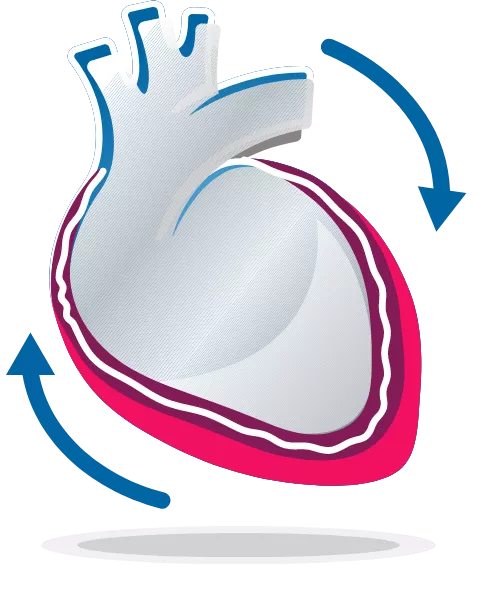 Recurrent Pericarditis Heart Graphic