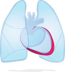 Inflamed Pericardium Graphic
