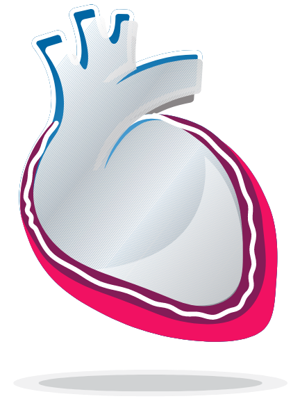 One-Time Pericarditis Heart Graphic