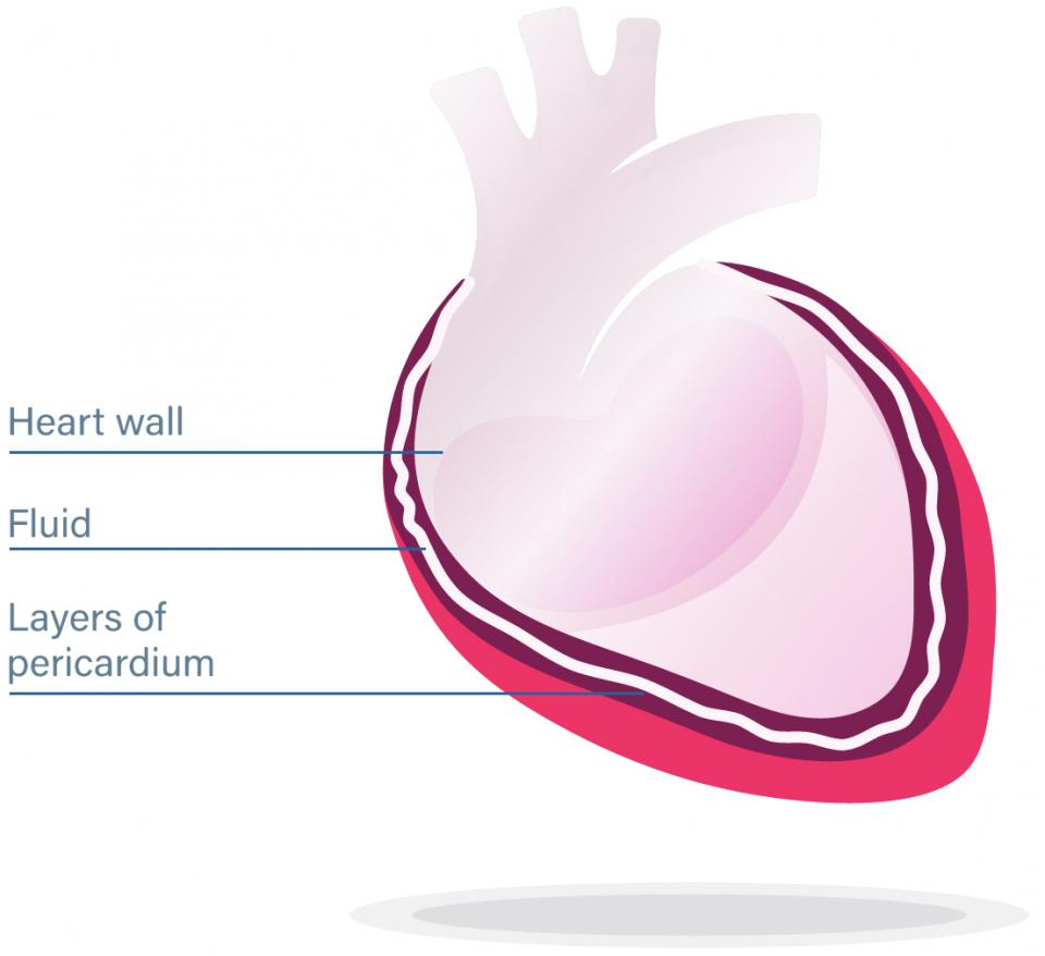Unhealthy Heart