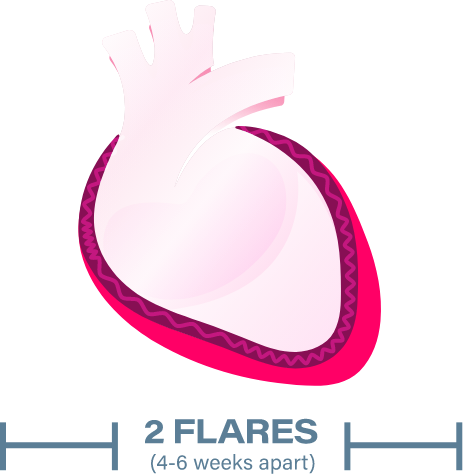 Recurrent pericarditis