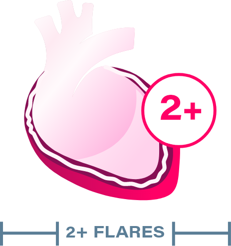 Second Flare