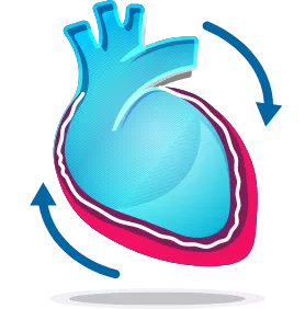 Recurrent Pericarditis Heart Graphic